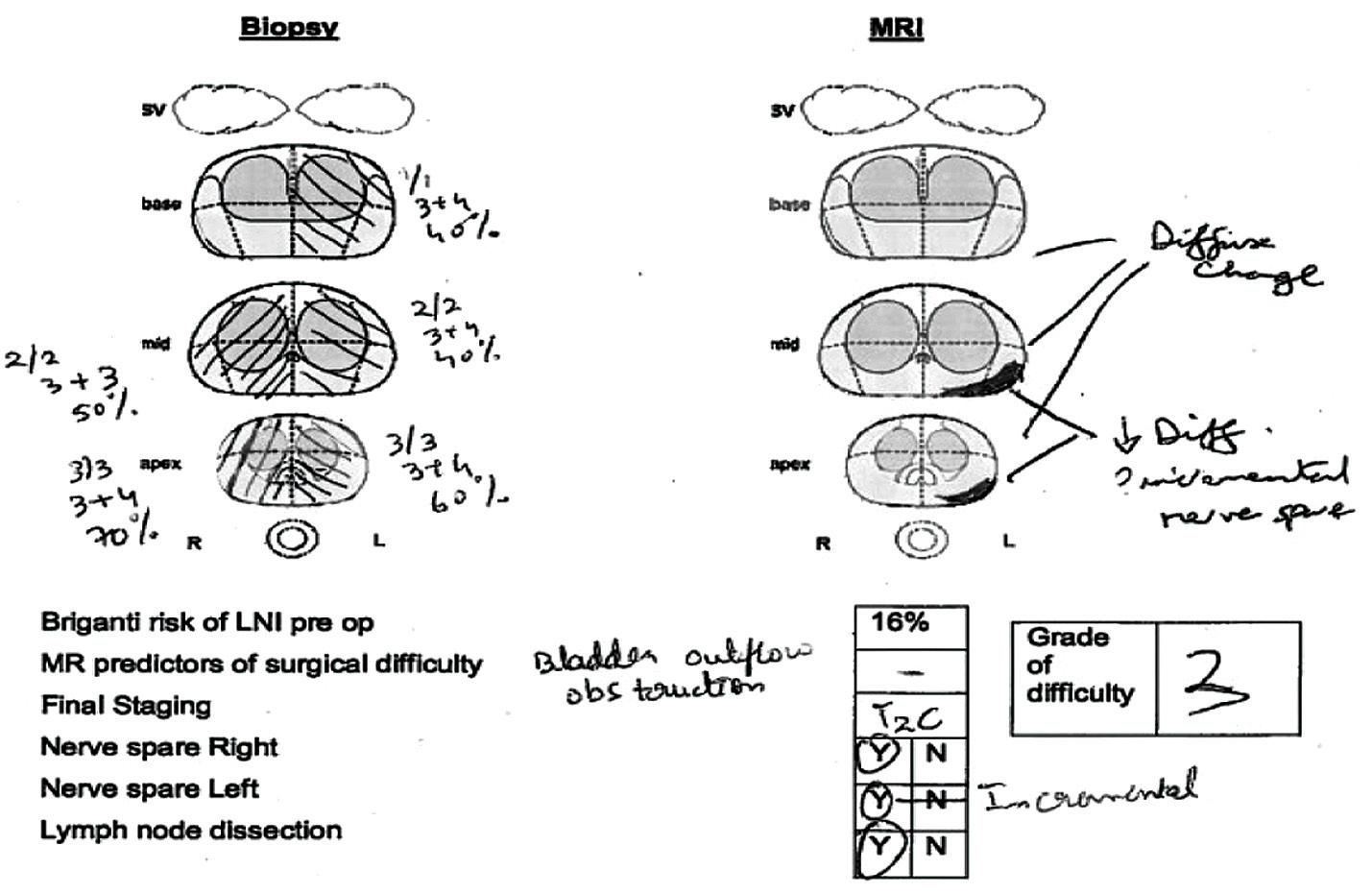 Rectal cancer on mri, Biomedical Signal Processing and Modeling Complexity of Living Systems