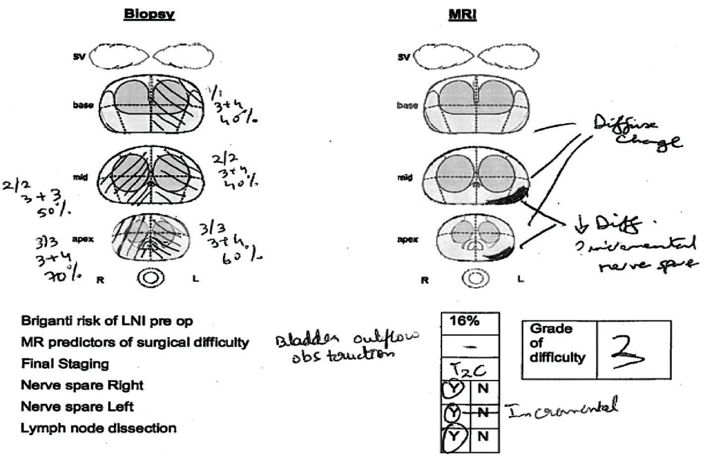 Multiparametric Mri In Prostate Cancer Cancer World Archive