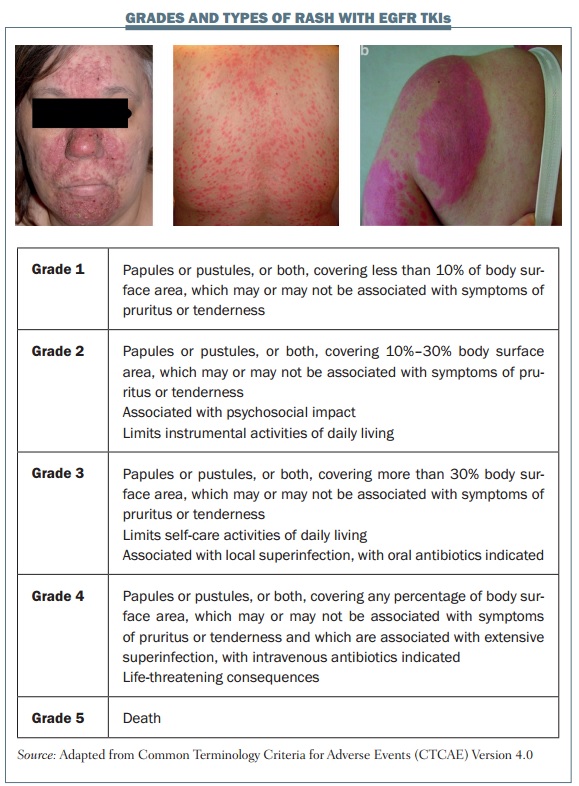 Skin Rash Grading