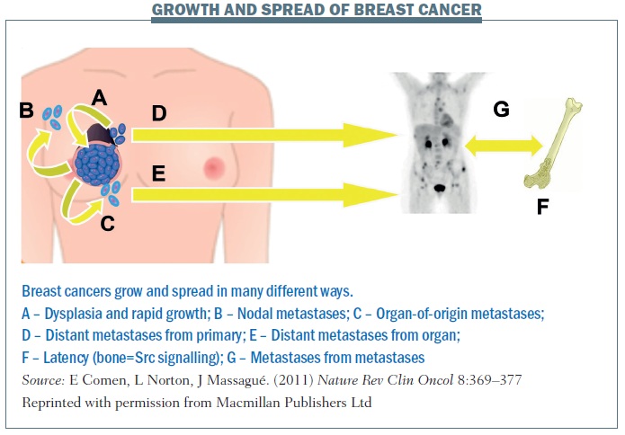 metastatic cancer growth