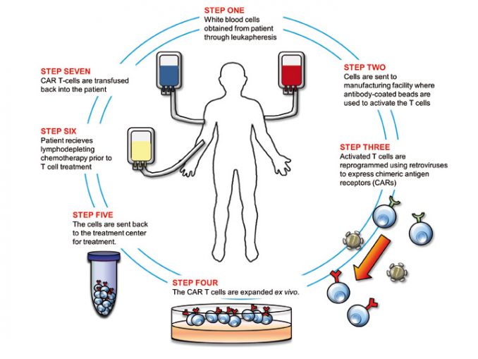 The Car T cell revolution what does it offer, and can we afford it